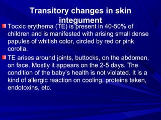 A newborn child. Transition states in Newborn period. Premature and ...