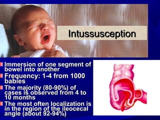 Surgical diseases of Abdominal in children | PPT