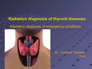 Radiation diagnosis of thyroid diseasesRadiation diagnosis of thyroid diseases
Radiation diagnosis of emergency conditions
Dr. Lenchuk Tatyana
Phd
 