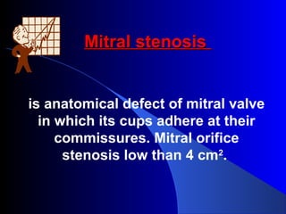 Mitral stenosisMitral stenosis
is anatomical defect of mitral valve
in which its cups adhere at their
commissures. Mitral orifice
stenosis low than 4 cm2
.
 
