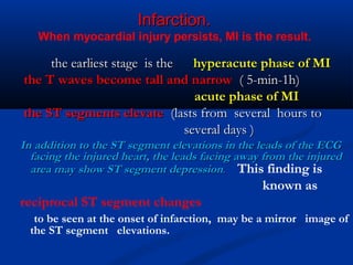 Acute Coronary Syndrome | PPT