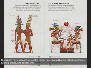 Image source: http://www.nationalgeographic.com/magazine/2017/05/akhenaten-revolutionary-egypt-king-art-architecture/
The figures have strangely elongated skulls, pear-shaped bodies with skinny torsos,
swelling bellies, and spindly arms
 