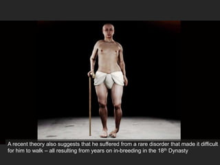 A recent theory also suggests that he suffered from a rare disorder that made it difficult
for him to walk – all resulting from years on in-breeding in the 18th Dynasty
 