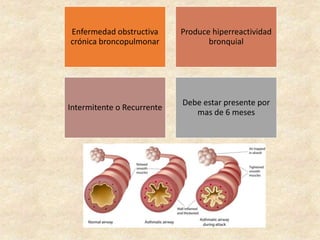 Enfermedad obstructiva
crónica broncopulmonar
Produce hiperreactividad
bronquial
Intermitente o Recurrente
Debe estar presente por
mas de 6 meses
 