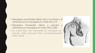 • Marcapasos unicamerales (afecta sólo a la aurícula o al
ventrículo) son los marcapasos en modo AAI y VVI
• Marcapasos bicamerales (afecta a aurículas y
ventrículos) son marcapasos en modo VDD y DDD.
• Los cuatro tipos más importantes de marcapaso son:
auricular (AAI), ventricular (VVI) y auriculoventriculares
(VDD y DDD).
 