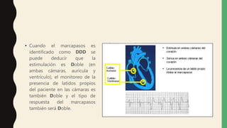 • Cuando el marcapasos es
identificado como DDD se
puede deducir que la
estimulación es Doble (en
ambas cámaras, aurícula y
ventrículo), el monitoreo de la
presencia de latidos propios
del paciente en las cámaras es
también Doble y el tipo de
respuesta del marcapasos
también será Doble.
 