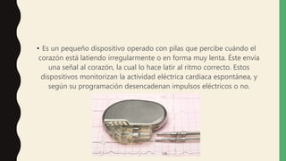 • Es un pequeño dispositivo operado con pilas que percibe cuándo el
corazón está latiendo irregularmente o en forma muy lenta. Éste envía
una señal al corazón, la cual lo hace latir al ritmo correcto. Estos
dispositivos monitorizan la actividad eléctrica cardiaca espontánea, y
según su programación desencadenan impulsos eléctricos o no.
 