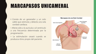 MARCAPASOS UNICAMERAL
• Consta de un generador y un solo
cable que estimula y detecta una sola
cavidad cardíaca.
• Afecta sólo a la aurícula o al ventrículo
a una frecuencia determinada por la
programación.
• La estimulación cesará cuando se
produzca ritmo propio del paciente.
 