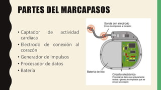 PARTES DEL MARCAPASOS
• Captador de actividad
cardiaca
• Electrodo de conexión al
corazón
• Generador de impulsos
• Procesador de datos
• Batería
 
