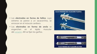 • Los electrodos en forma de hélice, cuyo
extremo se parece a un sacacorchos, se
enroscan en el músculo cardiaco.
• Los electrodos en forma de ancla se
enganchan en el tejido muscular
del corazón. Allí se fijan los garfios.
 