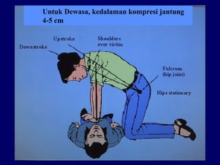 Compresi Rjp Cardiopulmonary Resuscitation (CPR) atau Resusitasi Jantung Paru-paru | PPT