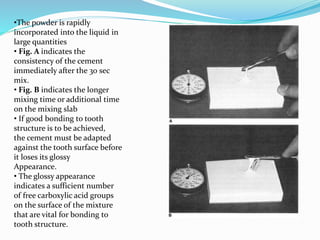 •The powder is rapidly
incorporated into the liquid in
large quantities
• Fig. A indicates the
consistency of the cement
immediately after the 30 sec
mix.
• Fig. B indicates the longer
mixing time or additional time
on the mixing slab
• If good bonding to tooth
structure is to be achieved,
the cement must be adapted
against the tooth surface before
it loses its glossy
Appearance.
• The glossy appearance
indicates a sufficient number
of free carboxylic acid groups
on the surface of the mixture
that are vital for bonding to
tooth structure.
 