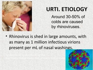 URTI. ETIOLOGY
• Rhinovirus is shed in large amounts, with
as many as 1 million infectious virions
present per mL of nasal washings.
Rhinovirus; Coryza Viruses; Common Cold Virus
http://www.lookfordiagnosis.com/mesh_info.php?term=Rhinovirus&lang=1
Around 30-50% of
colds are caused
by rhinoviruses.
 
