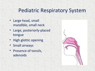 Pediatric Respiratory System
• Large head, small
mandible, small neck
• Large, posteriorly-placed
tongue
• High glottic opening
• Small airways
• Presence of tonsils,
adenoids
 
