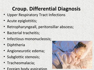 Croup. Differential Diagnosis
• Upper Respiratory Tract Infections
• Acute epiglottitis;
• Retropharyngeall, peritonsillar abscess;
• Bacterial tracheitis;
• Infectious mononucleosis;
• Diphtheria
• Angioneurotic edema;
• Subglottic stenosis;
• Tracheomalacia;
•
 