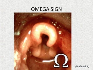 OMEGA SIGN
(Dr.FaceB..k)
 