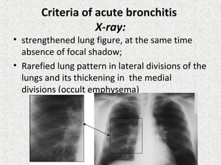 Criteria of acute bronchitis
X-ray:
• strengthened lung figure, at the same time
absence of focal shadow;
• Rarefied lung pattern in lateral divisions of the
lungs and its thickening in the medial
divisions (occult emphysema)
 