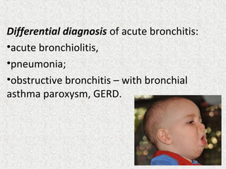 Differential diagnosis of acute bronchitis:
•acute bronchiolitis,
•pneumonia;
•obstructive bronchitis – with bronchial
asthma paroxysm, GERD.
 