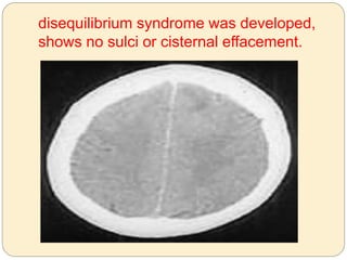 disequilibrium syndrome was developed,
shows no sulci or cisternal effacement.
 