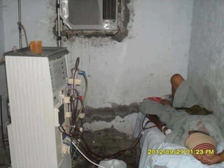 Hemodialysis complications 