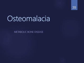 Osteomalacia
METABOLIC BONE DISEASE
35
 
