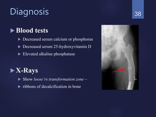 Diagnosis
 Blood tests
 Decreased serum calcium or phosphorus
 Decreased serum 25-hydroxyvitamin D
 Elevated alkaline phosphatase
 X-Rays
 Show loose’rs transformation zone –
 ribbons of decalcification in bone
38
 