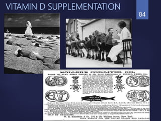 VITAMIN D SUPPLEMENTATION
84
 