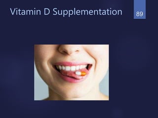 89Vitamin D Supplementation
 