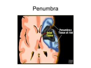 Penumbra
 