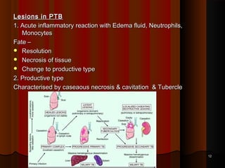 Lesions in PTBLesions in PTB
1. Acute inflammatory reaction with Edema fluid, Neutrophils,1. Acute inflammatory reaction with Edema fluid, Neutrophils,
MonocytesMonocytes
Fate –Fate –
 ResolutionResolution
 Necrosis of tissueNecrosis of tissue
 Change to productive typeChange to productive type
2. Productive type2. Productive type
Characterised by caseaous necrosis & cavitation & TubercleCharacterised by caseaous necrosis & cavitation & Tubercle
1212
 