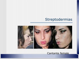 Streptodermias
Cantante female
 