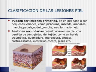 CLASIFICACION DE LAS LESIONES PIEL
 Pueden ser lesiones primarias, en en piel sana o con
pequeñas lesiones, como picaduras, rascado, arañazos;.
mancha,papula,nodulo,roncha, neo formación etc.
 Lesiones secundarias cuando ocurren en piel con
perdida de contigüidad del tejido, como en herida
traumática, quemadura, mordedura, cirugía.
costra,escama, ulceraciòn,escara, placa etc.
 