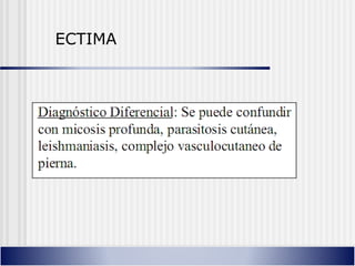 ECTIMA
 