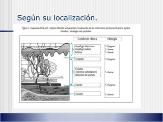 Según su localización.
 
