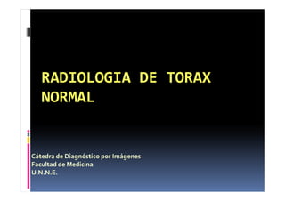 RADIOLOGIA DE TORAXRADIOLOGIA DE TORAX
NORMALNORMALNORMALNORMAL
Cátedra de Diagnóstico por Imágenes
Facultad de Medicina
U.N.N.E.
 