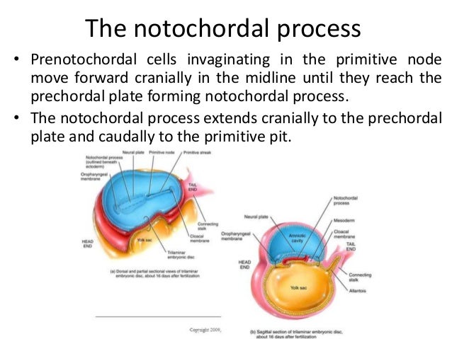 3 formation of notochord 