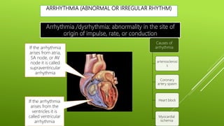ARRHYTHMIA (ABNORMAL OR IRREGULAR RHYTHM)
If the arrhythmia
arises from the
ventricles it is
called ventricular
arrhythmia
If the arrhythmia
arises from atria,
SA node, or AV
node it is called
supraventricular
arrhythmia
Causes of
arrhythmia
arteriosclerosi
s
Coronary
artery spasm
Heart block
Myocardial
ischemia
 