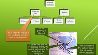 Abnormal
conduction
Conduction
block
1st degree 2nd degree 3rd degree
Reentry
Circus
movement
Reflection
This is when the impulse is
not conducted from the
atria to the ventricles
1-This
pathway is
blocked
2-The impulse from
this pathway travels
in a retrograde
fashion (backward)
3-So the cells here will
be reexcited (first by the
original pathway and the
other from the
retrograde)
 