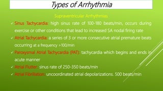 Supraventricular Arrhythmias
 Sinus Tachycardia: high sinus rate of 100-180 beats/min, occurs during
exercise or other conditions that lead to increased SA nodal firing rate
 Atrial Tachycardia: a series of 3 or more consecutive atrial premature beats
occurring at a frequency >100/min
 Paroxysmal Atrial Tachycardia (PAT): tachycardia which begins and ends in
acute manner
 Atrial Flutter: sinus rate of 250-350 beats/min.
 Atrial Fibrillation: uncoordinated atrial depolarizations. 500 beats/min
Types of Arrhythmia
 