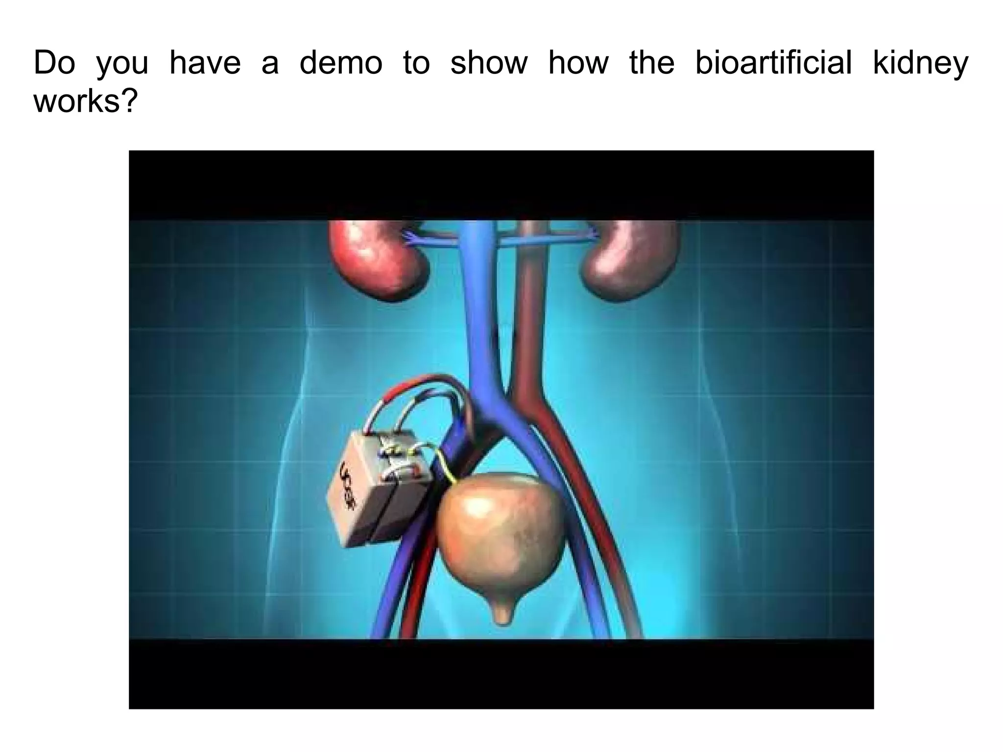 The Kidney Project: Facebook Chat Recap | PPT | Free Download