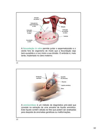 10
A fecundação in vitro permite juntar o espermatozoide e o
oócito fora do organismo de modo que a fecundação seja
bem-sucedida e o ovo inicie a sua divisão. O embrião é, mais
tarde, implantado no útero materno.
Extração
de oócitos
Colocação
do oócito
in vitro
Colocação de
espermatozoides
in vitro
Fecundação
in vitro
Embrião
Colocação
do embrião
no útero
Nidação
A amniocintese é um método de diagnóstico pré-natal que
consiste na extração de uma amostra de líquido amniótico.
Este líquido contém células do feto que podem ser analisadas
para despiste de anomalias genéticas ou malformações.
Aparelho
de ultrassons
Seringa de
aspiração
Placenta
Útero
Líquido amniótico
19
20
 