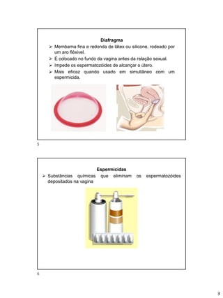 3
Diafragma
➢ Membarna fina e redonda de látex ou silicone, rodeado por
um aro fléxivel.
➢ É colocado no fundo da vagina antes da relação sexual.
➢ Impede os espermatozóides de alcançar o útero.
➢ Mais eficaz quando usado em simultâneo com um
espermicida.
Espermicidas
➢ Substâncias químicas que eliminam os espermatozóides
depositados na vagina
5
6
 