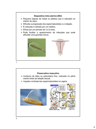 4
Dispositivo intra-uterino (DIU)
➢ Pequeno objecto de metal ou plástico que é colocado no
interior do útero .
➢ Dificulta a progressão dos espermatozóides e a nidação.
➢ É colocado e retirado por um médico.
➢ Eficaz por um período de 3 a 5 anos.
➢ Pode facilitar o aparecimento de infecções que pode
dificultar uma gravidez futura.
Preservativo masculino
➢ Invólucro de latex ou poliuretano fino, colocado no pénis
erecto antes da relação sexual.
➢ Impede a entrada dos espermatozóides na vagina.
7
8
 