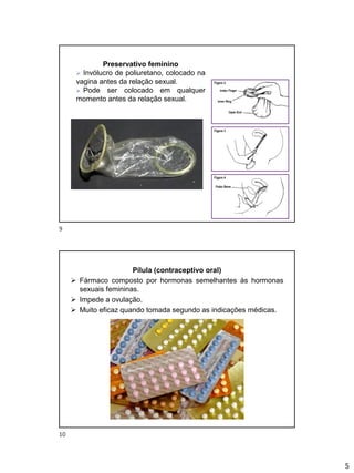 5
Preservativo feminino
➢ Invólucro de poliuretano, colocado na
vagina antes da relação sexual.
➢ Pode ser colocado em qualquer
momento antes da relação sexual.
Pílula (contraceptivo oral)
➢ Fármaco composto por hormonas semelhantes às hormonas
sexuais femininas.
➢ Impede a ovulação.
➢ Muito eficaz quando tomada segundo as indicações médicas.
9
10
 