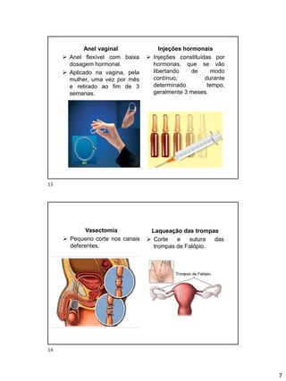 7
Anel vaginal
➢ Anel flexível com baixa
dosagem hormonal.
➢ Aplicado na vagina, pela
mulher, uma vez por mês
e retirado ao fim de 3
semanas.
Injeções hormonais
➢ Injeções constituídas por
hormonas, que se vão
libertando de modo
contínuo, durante
determinado tempo,
geralmente 3 meses.
Vasectomia
➢ Pequeno corte nos canais
deferentes.
Laqueação das trompas
➢ Corte e sutura das
trompas de Falópio.
13
14
 