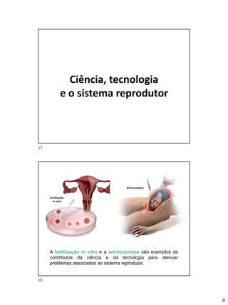 9
Ciência, tecnologia
e o sistema reprodutor
A fertilização in vitro e a amniocentese são exemplos de
contributos da ciência e da tecnologia para atenuar
problemas associados ao sistema reprodutor.
Fertilização
in vitro
Amniocentese
17
18
 