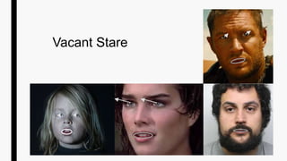 Vacant Stare
 