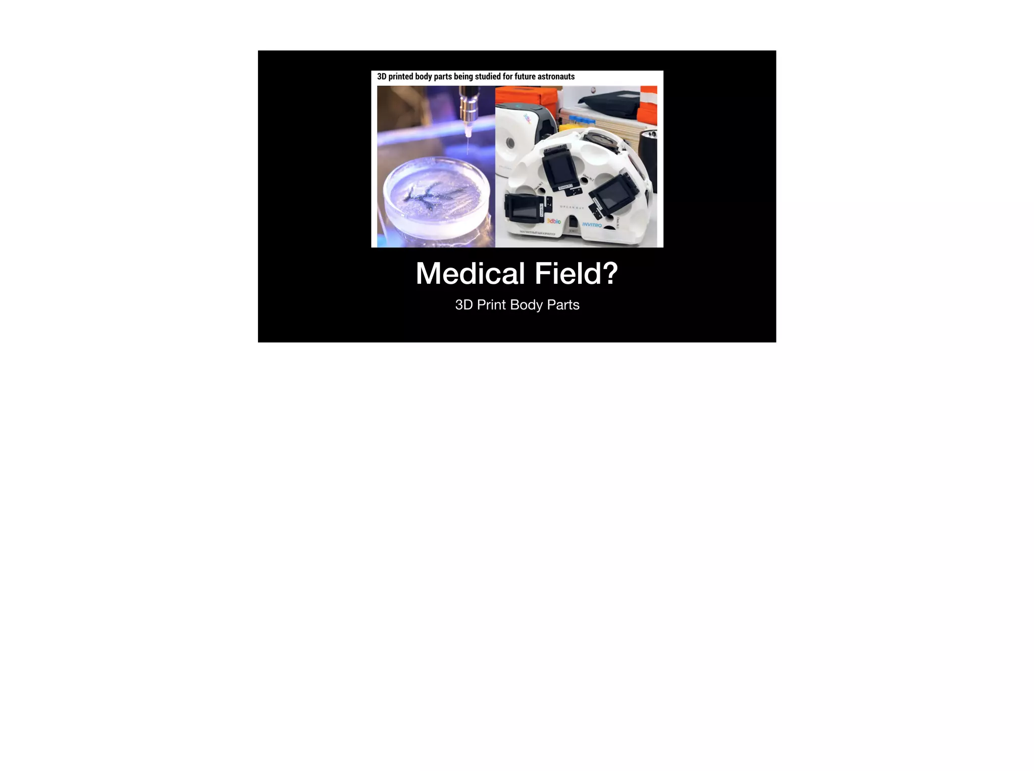 Medical Field?
3D Print Body Parts
 