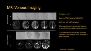 3. mri in acute stroke 2017 vietnam v2 | PPTX