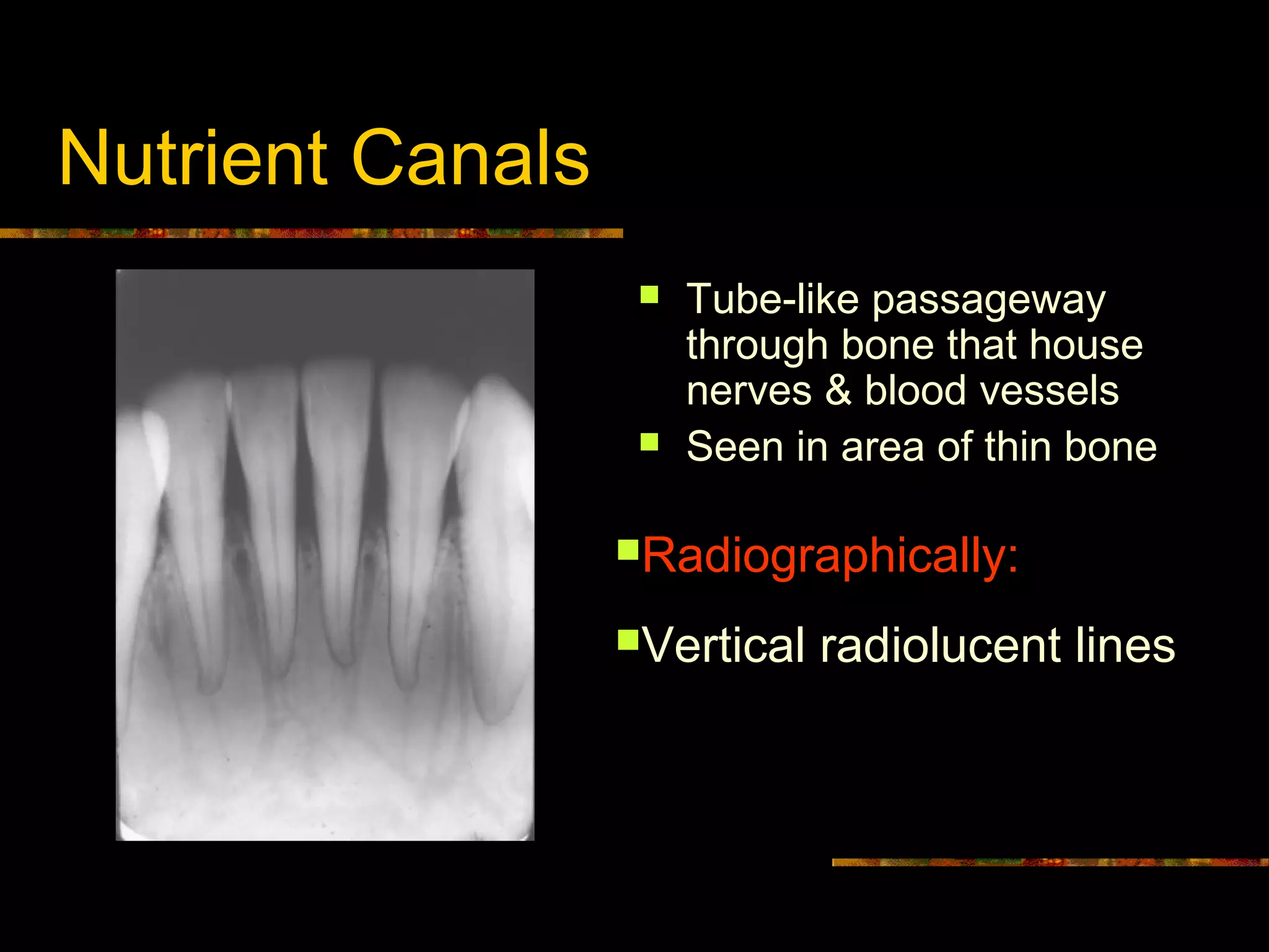 Intra Oral radiographic anatomical landmarks | PPT